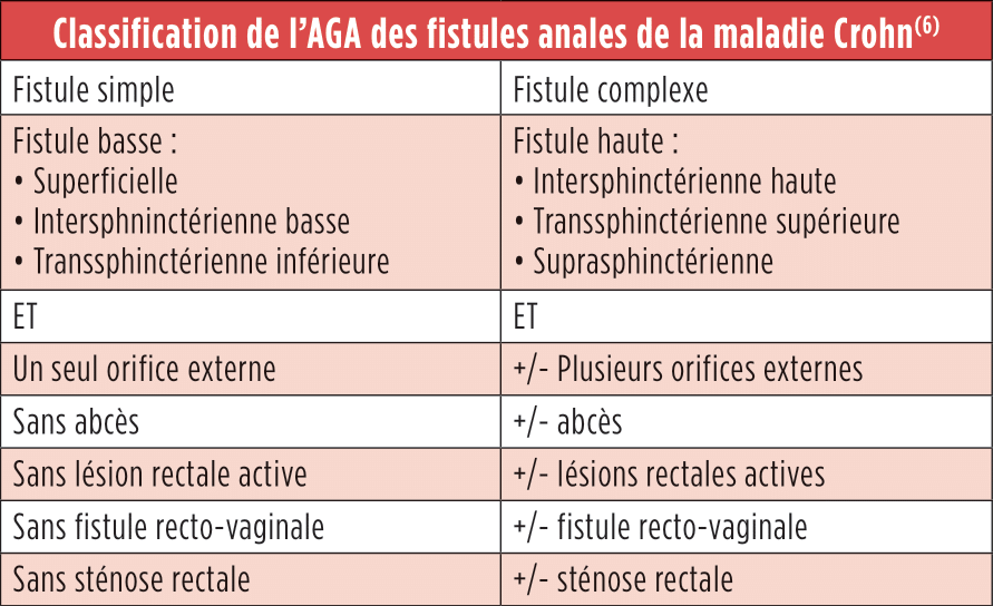 Tableau de classification de l'AGA des fistules anales de la maladie de Crohn